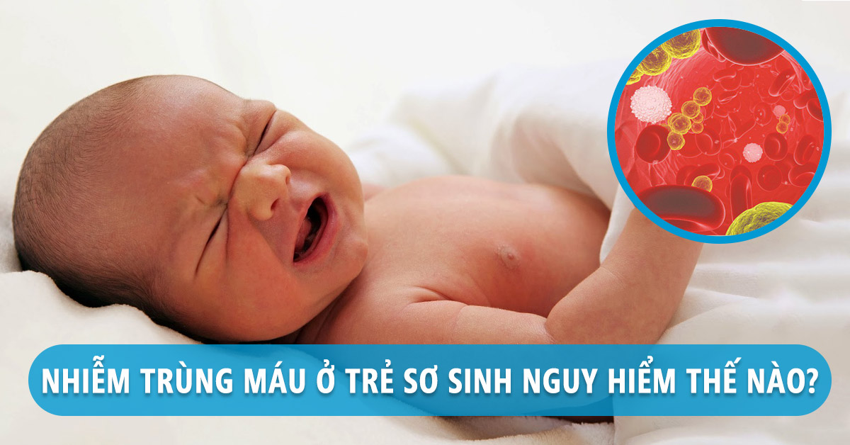 Nhiễm Khuẩn Sớm ở Trẻ Sơ Sinh Nhận Biết Và Cách Dự Phòng 