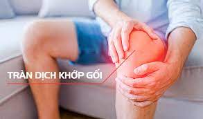 Tràn dịch khớp gối - Điều trị thế nào?