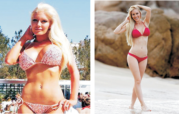 Chuyện đôi gò bồng đảo - Heidi Montag