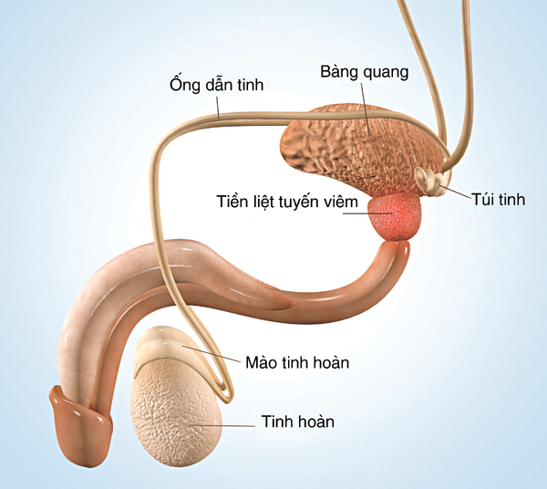 viem tuyen tien liet