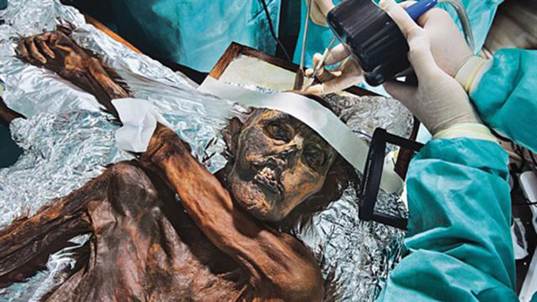 Người băng Otzi