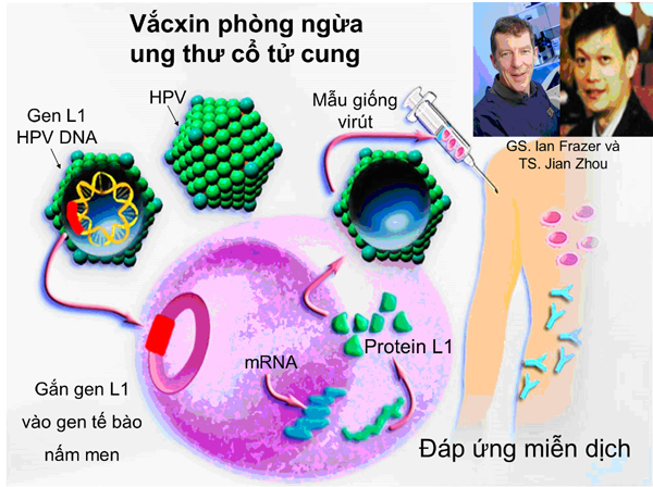 ung thư cổ tử cung