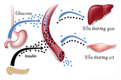 Thuốc trị rối loạn lipid máu statin