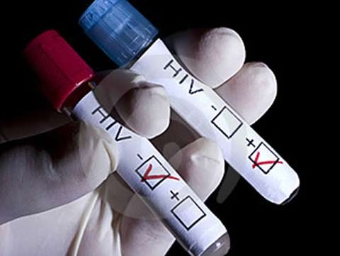 Xét nghiệm HIV
