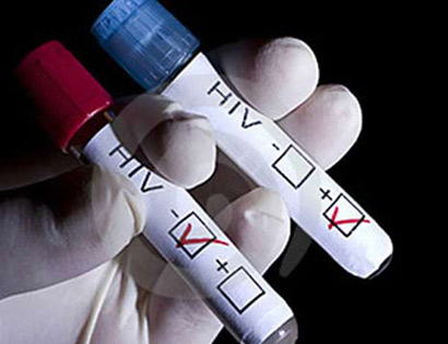 Các liệu pháp điều trị HIV mới