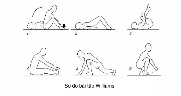 Điều trị và phòng ngừa đau thắt lưng