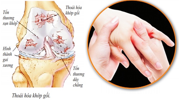 Người cao tuổi mắc bệnh khớp nên tập luyện thế nào?
