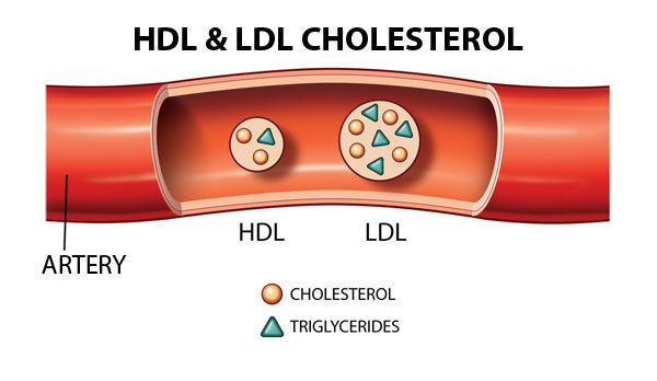 Cholesterol