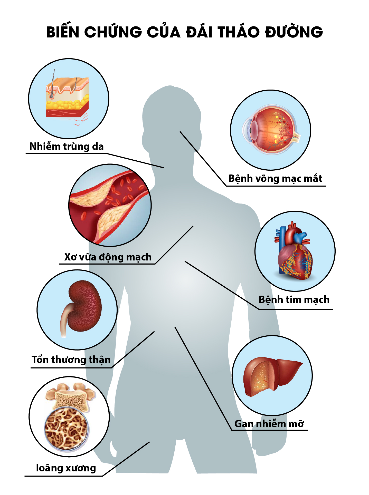 Giúp sống khỏe với bệnh đái tháo đường