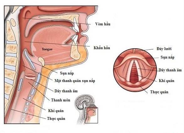Viêm sụn nắp cấp: Bệnh lý tai mũi họng không thể coi thường