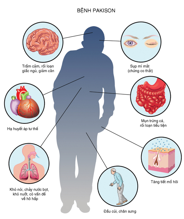 Thuốc chữa Parkinson levodopa