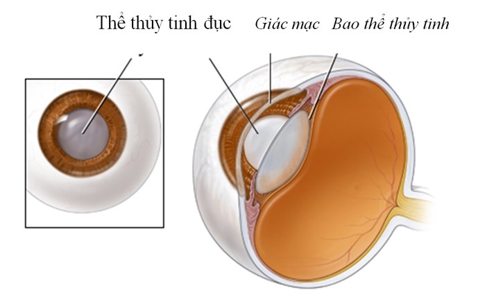 Phòng bất lợi của thuốc như thế nào?