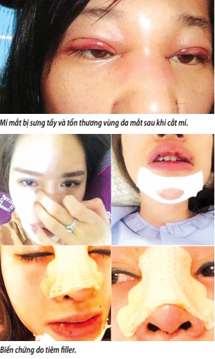 Ðiểm lại những vụ tai biến kinh hoàng do “nâng cấp” cơ thể