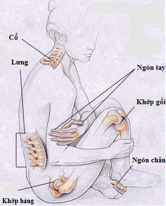 Vài lời khuyên cho người bệnh thoái hóa khớp