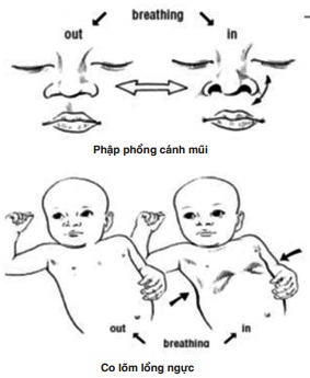 Cách điều trị các bệnh hô hấp khi chuyển mùa ở trẻ