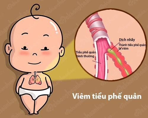 Phương pháp giảm ho không dùng thuốc