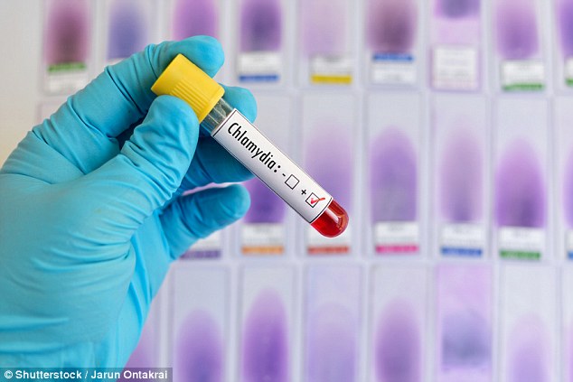 Chlamydia làm tăng gấp đôi nguy cơ ung thư buồng trứng