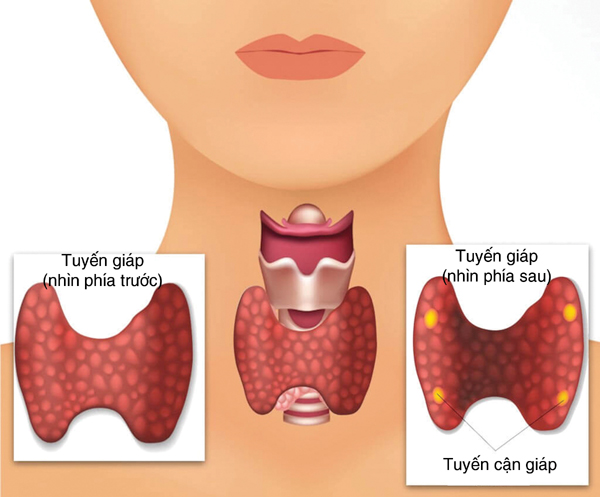 Các thuốc điều trị một số bệnh lý tuyến giáp