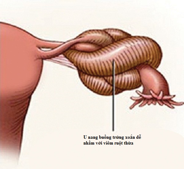 Những lầm lẫn trong ngoại khoa