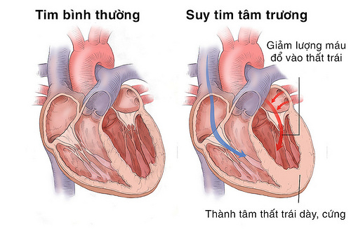 Ðối tượng dễ bị nhiễu loạn tâm thần
