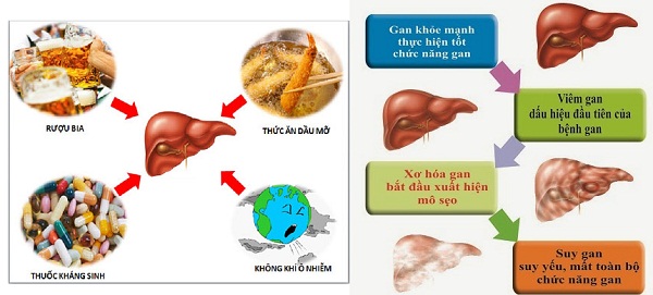 Coi chừng tổn thương gan do thuốc