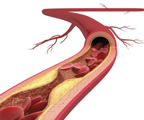 Nhóm thuốc statin làm giảm nguy cơ tử vong do các bệnh lý tim mạch ở nam giới