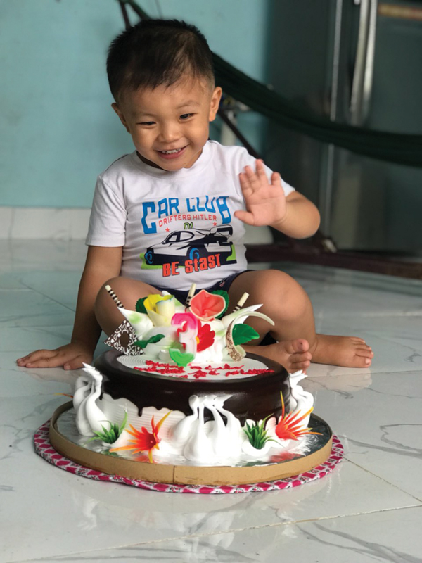 “Cậu bé bị đâm xuyên sọ”  khỏe mạnh tuổi lên 3