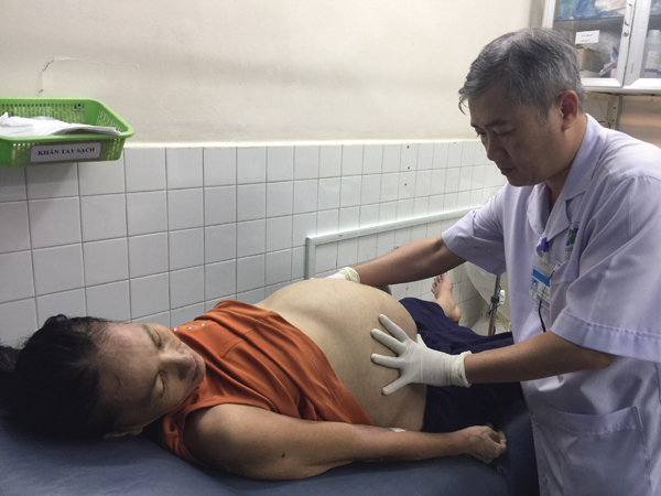 Phận khó đành vác nặng khối u 20kg trong bụng!