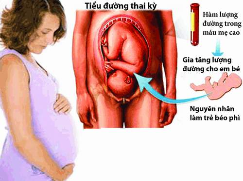 Chủ động phòng ngừa đái tháo đường thai kỳ