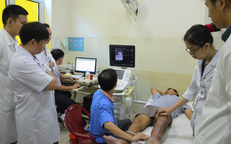 Tiếp nhận kỹ thuật điều trị suy giãn tĩnh mạch chi dưới