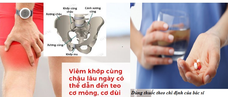 Viêm khớp cùng chậu và lưu ý đặc biệt khi dùng thuốc