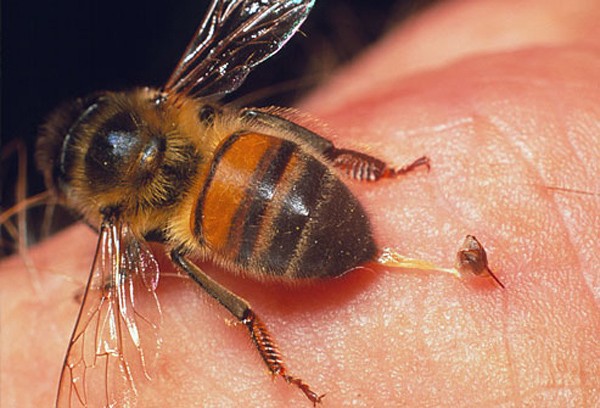 Trải qua một lần bị ong đốt chắc chắn là điều khó chịu, tuy nhiên hãy xem hình ảnh liên quan để biết cách xử lý kịp thời để giảm đau và sưng tấy.