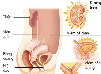 4. Phương Pháp Chẩn Đoán Viêm Đường Tiết Niệu Ở Mẹ Bầu