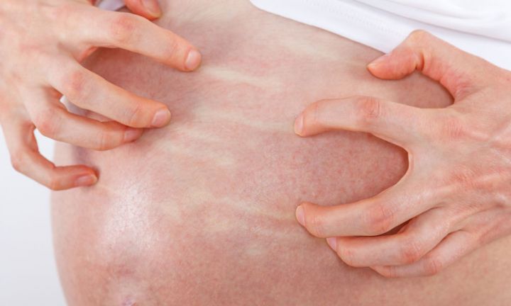 Ðối phó với bệnh gan trong thai kỳ