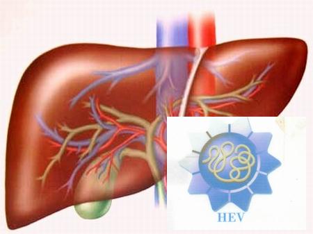 Bệnh viêm gan E nguy hiểm thế nào?