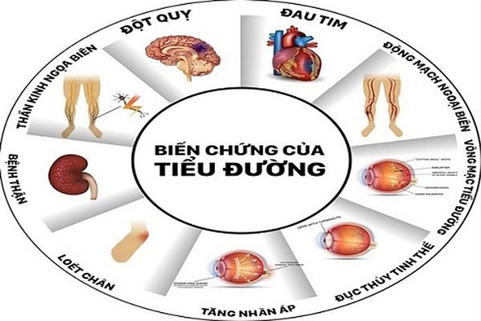 bệnh đái tháo đường