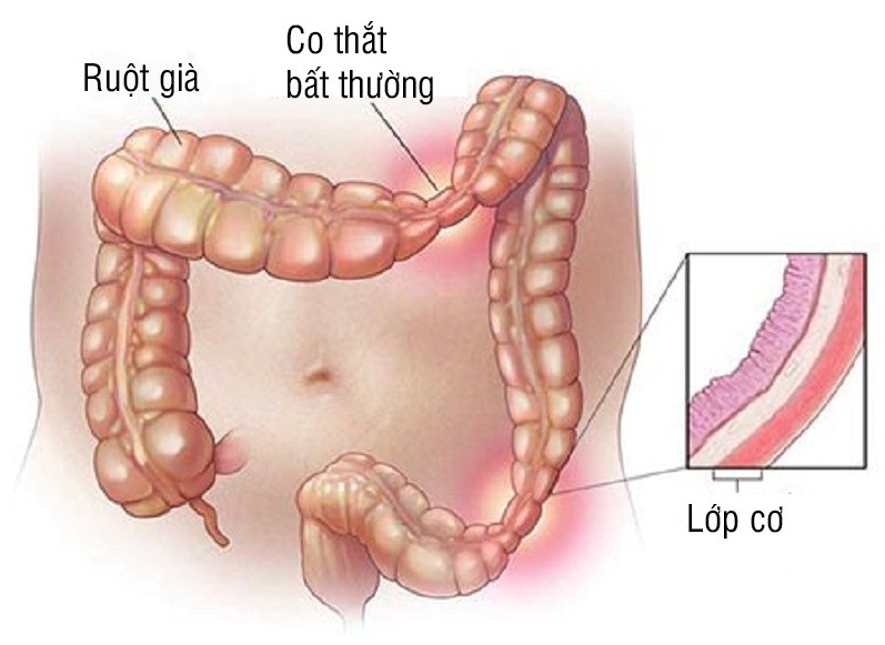 Không ăn mà vẫn thấy no