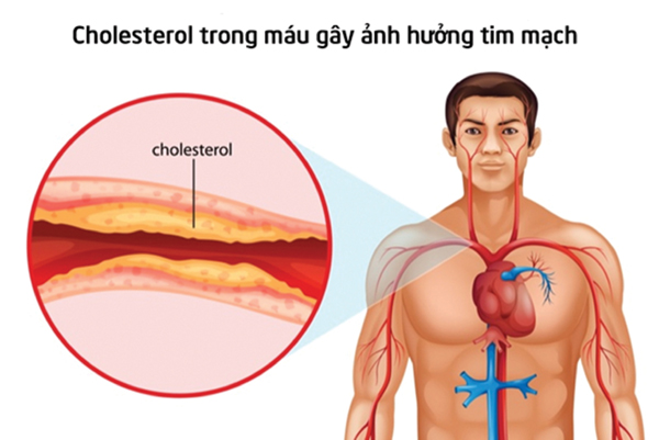 Hiểu đúng về mỡ và cách loại bỏ chúng khỏi cơ thể