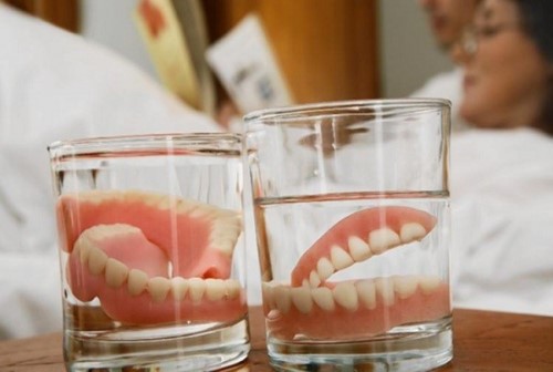 Lựa chọn răng giả và lời khuyên của bác sĩ