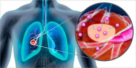 Nanomedicine và hàng rào sinh học của cơ thể
