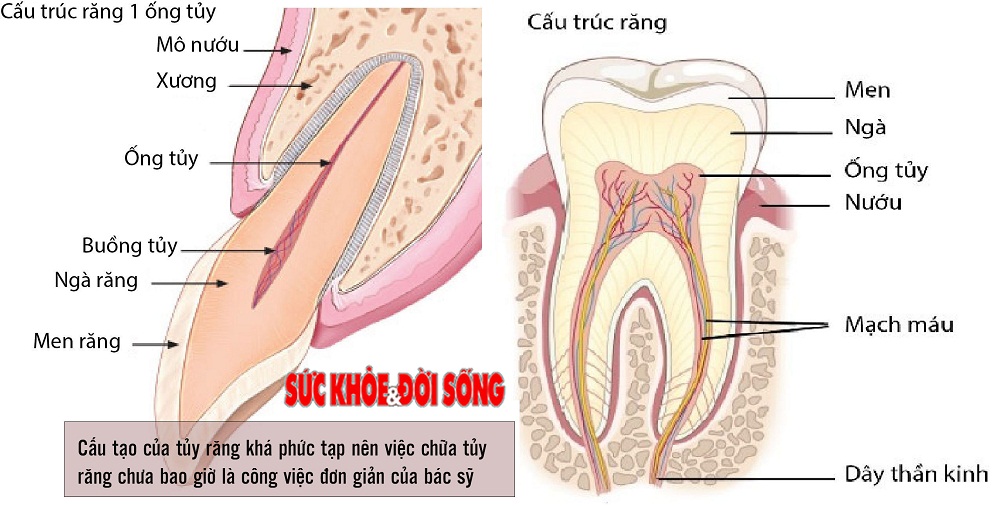 Điều trị tủy răng  Nha Khoa Thúy Đức