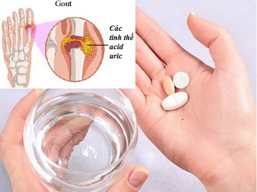 Dùng thuốc colchicine trị gút cần lưu ý gì?