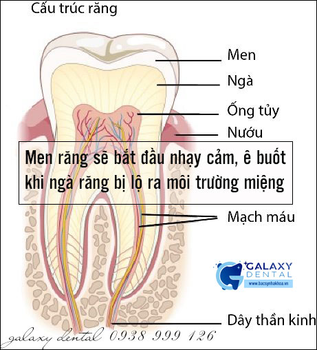 Răng ê buốt và cuộc chiến chống ê buốt