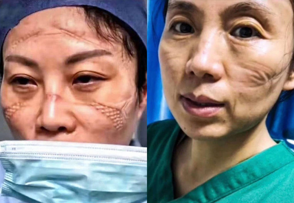 “Sự kỳ thị” - gánh nặng ngàn cân trên vai nhân viên y tế
