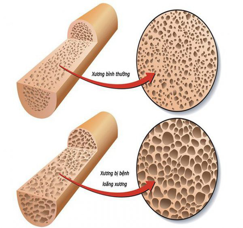 Cách dùng xương ngựa làm thuốc