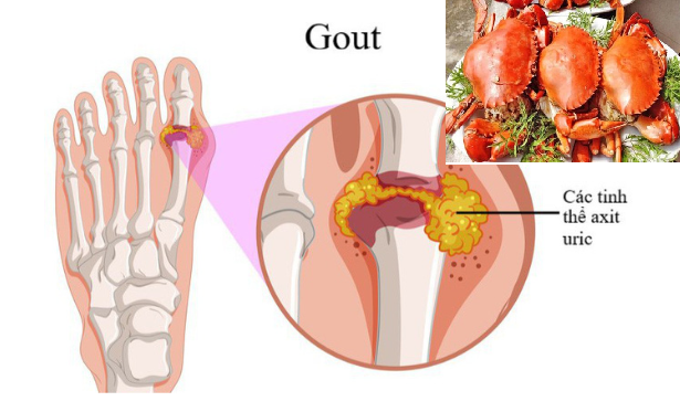 Những chú ý trong ăn, uống ở người mắc bệnh mạn tính