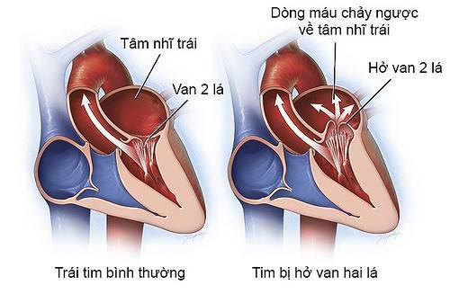 râm bụt