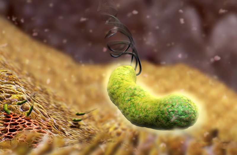 Diệt vi khuẩn H.Pylori