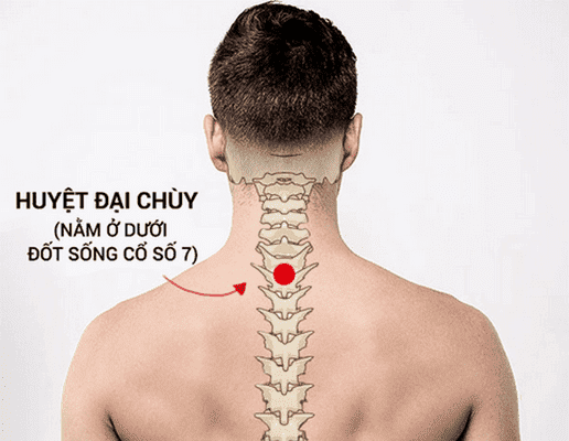 Day huyệt đại chùy trị cảm cúm, đau cổ vai gáy