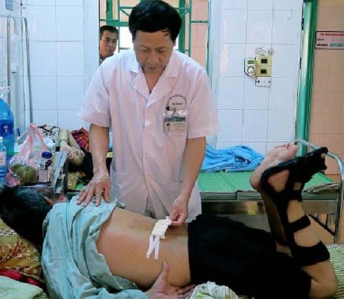 bơm xi măng sinh học